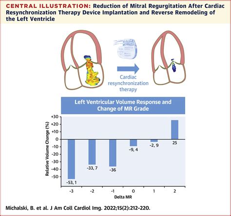 lv asynchrony mitral regurgitation echo|mitral regurgitation vs lv.